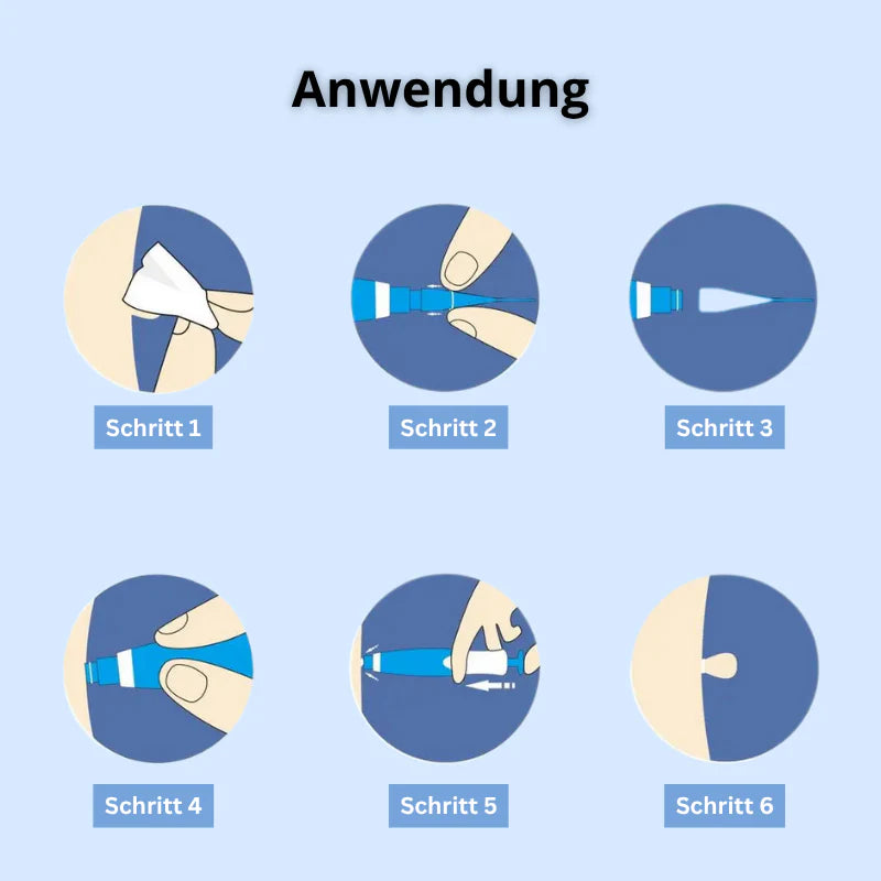 Dermalux™ | Nie wieder Hautanhängsel