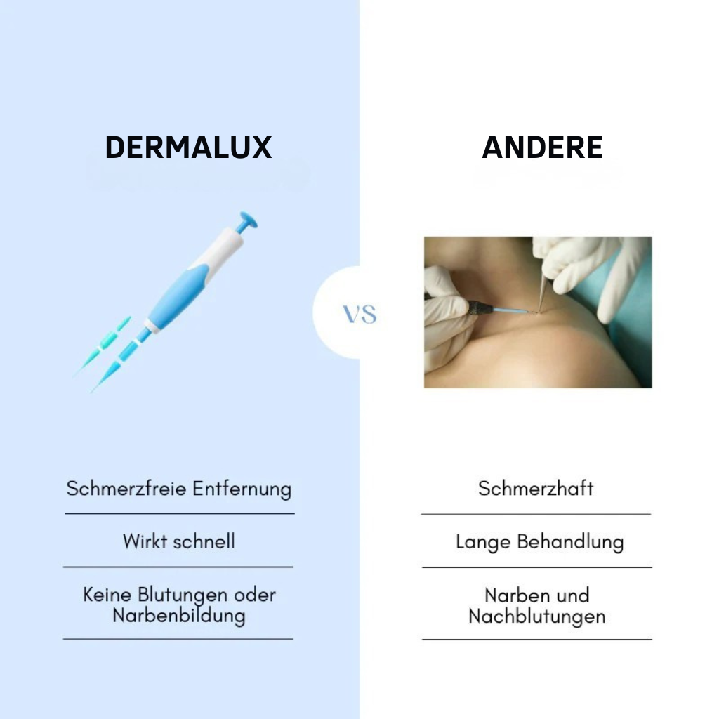 Dermalux™ | Nie wieder Hautanhängsel