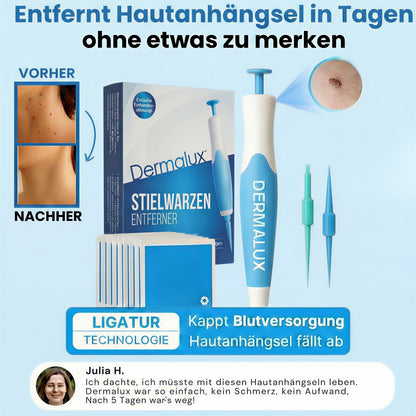 Dermalux® | Nie wieder Hautanhängsel