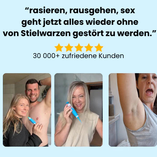 Dermalux™ | Nie wieder Hautanhängsel