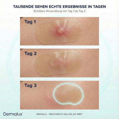 DermaTape™ | Pflaster gegen Narben und Akne
