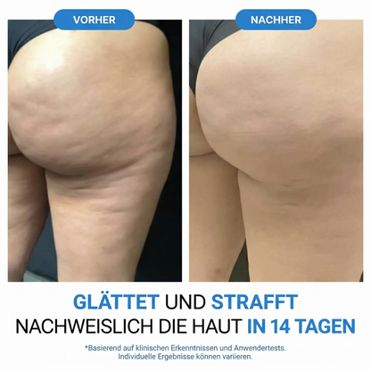 Dermalux® Cellulite Roller