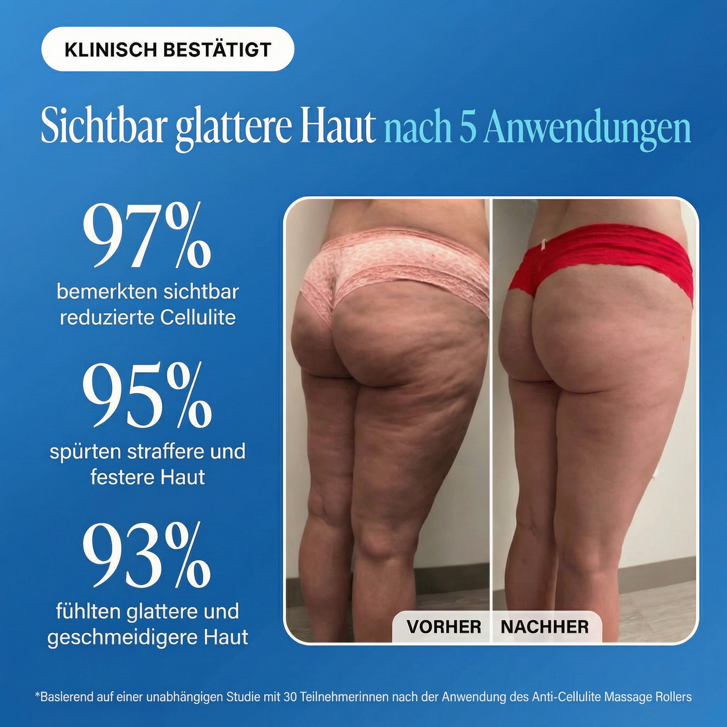 Dermalux® Cellulite Roller