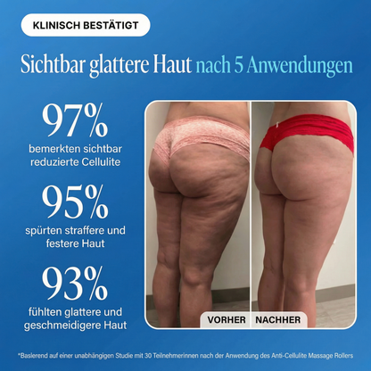 Dermalux® Cellulite Roller